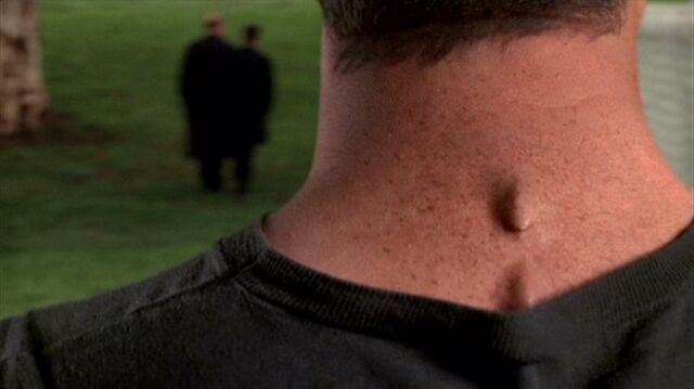 File:Knowle Rohrer's neck.jpg