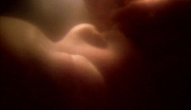 File:William as fetus.jpg