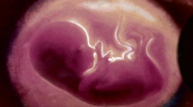 File:Fetus title.jpg